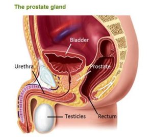 congested prostate gland treatment
